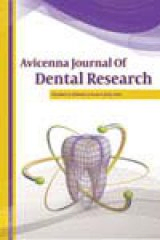 Color Change of Primary Teeth Following Using ۴ Types of Iron Supplements Available in the Iranian Pharmacopeia